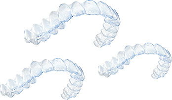 Invisalign aligners