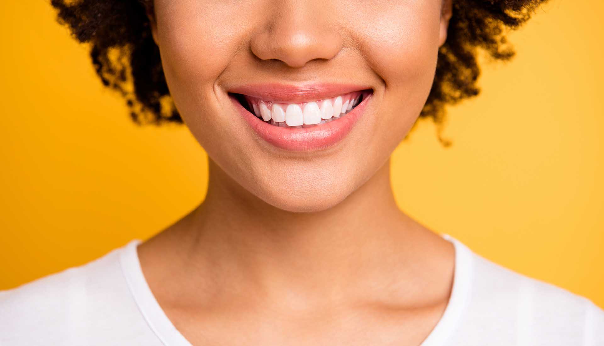 woman after teeth whitening showing her beautiful teeth in a smile