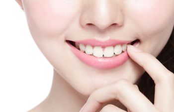 Smiling Woman Cosmetic Veneers